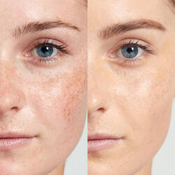 Hd Photogenic Concealer Wand Nyx Professional Makeup