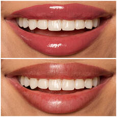 08 DRIPPIN IN ROSE shade of Lip I.V. Hydrating Lip Gloss Stain for both shine and stain.