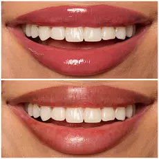 08 DRIPPIN IN ROSE shade of Lip I.V. Hydrating Lip Gloss Stain for both shine and stain.