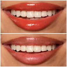 12 BURST THAT TANG! shade of Lip I.V. Hydrating Lip Gloss Stain for both shine and stain.
